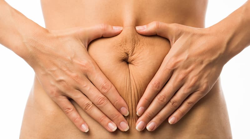 Woman making a heart shape across the sagging skin on her belly