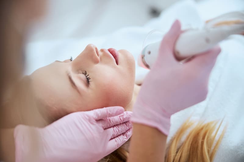 Woman getting radiofrequency microneedling treatment in a salon